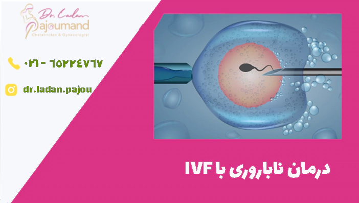 درمان ناباروری با IVF