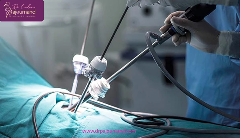 کاربرد لاپاراسکوپی