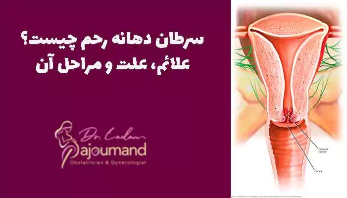 سرطان دهانه رحم چیست؟