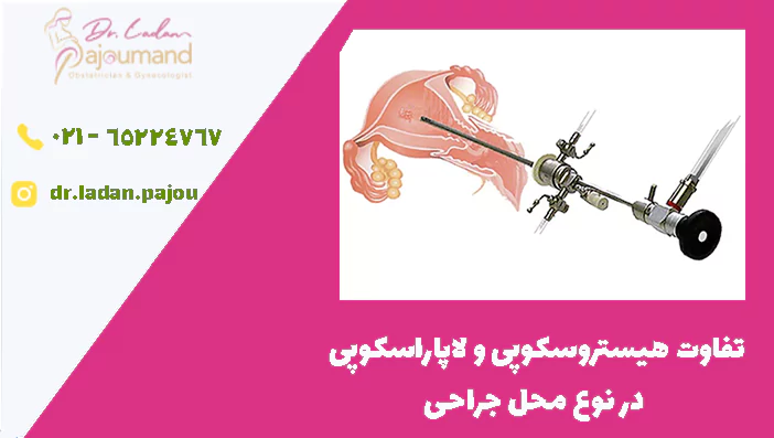 تفاوت هیستروسکوپی و لاپاراسکوپی در نوع محل جراحی