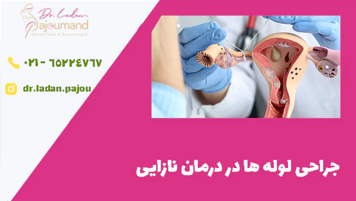 جراحی لوله ها در درمان نازایی